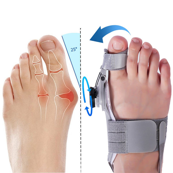 The Avena Bunion Fix on a foot