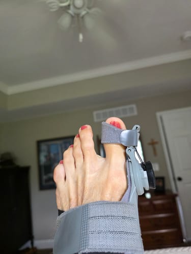 Customer photo of the Avena&trade; Bunion Fix