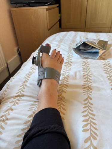 Customer photo of the Avena&trade; Bunion Fix