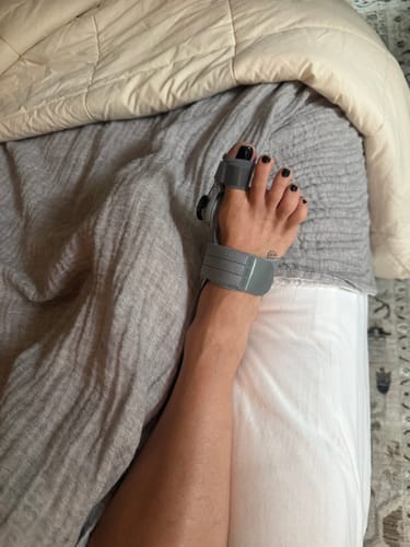 Customer photo of the Avena&trade; Bunion Fix