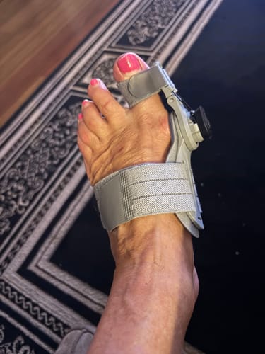 Customer photo of the Avena&trade; Bunion Fix