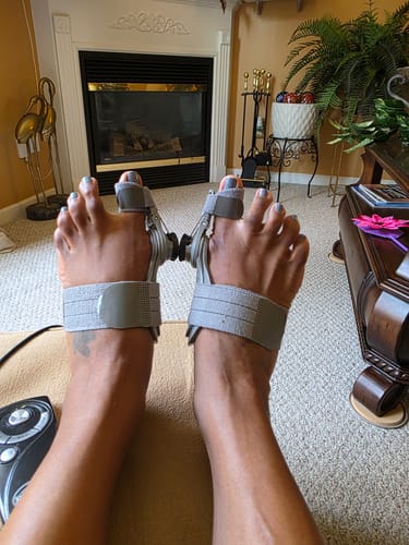 Customer photo of the Avena&trade; Bunion Fix