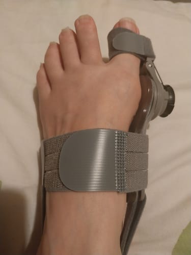 Customer photo of the Avena&trade; Bunion Fix