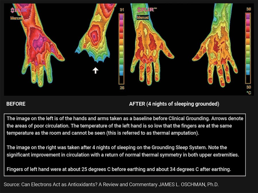 Illustration of grounding effects on the body